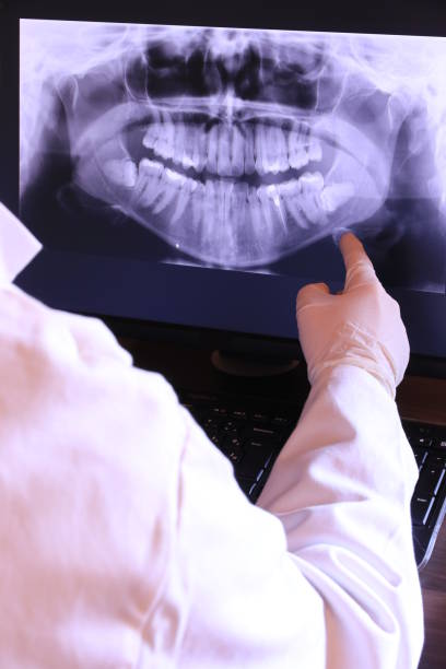 Best Emergency Wisdom Teeth Removal in Connersville, IN
