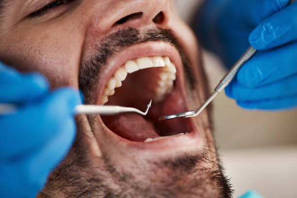 Best Emergency Treatment for Toothache in Connersville, IN
